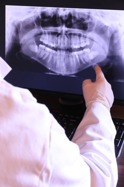 Best Emergency Dental Care for Sports Injuries in Cheney, KS