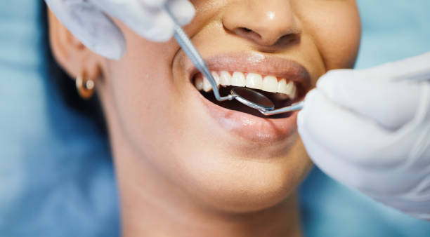 Best Emergency Cosmetic Dentistry (e.g., broken veneers) in Cheney, KS